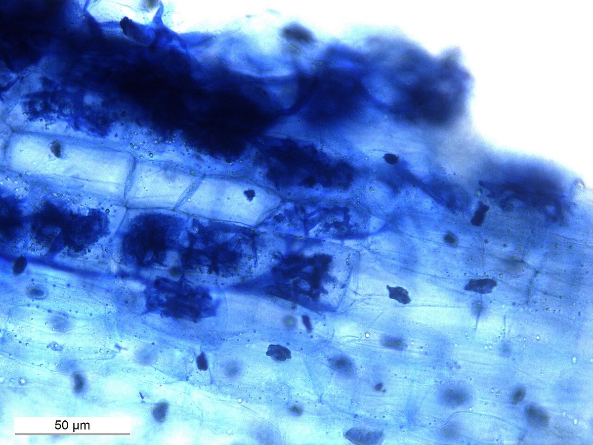 Mycorrhizal fungus inside plant root cells under a microscope.
